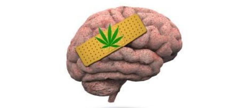 Naukowcy potwierdzają: każda ilość marihuany jest destrukcyjna dla mózgu!
