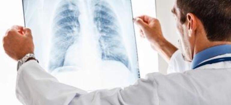 Zykadia zatwierdzona w leczeniu późnego stadium raka płuca