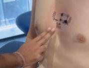 E-tatuaż umożliwi mobilne monitorowanie pracy...