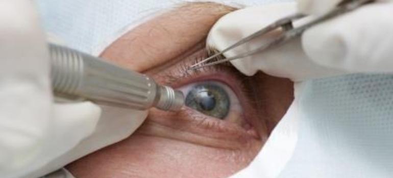 Najnowsza metoda usunięcia zaćmy może wyleczyć również inne wady wzroku 