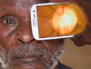 Peek Retina - badanie wzroku smartfonem