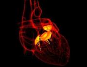 Nowa metoda wszczepiania zastawek serca