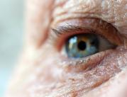 Choroby oczu mogą mieć związek z demencją