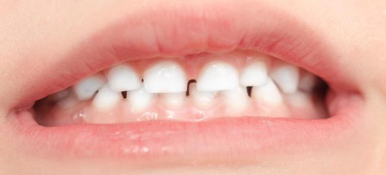 Znieczulenie miejscowe może wpływać na rozwój dziecięcych zębów?